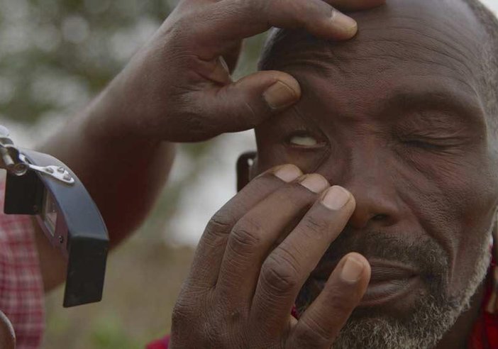 trachoma_video